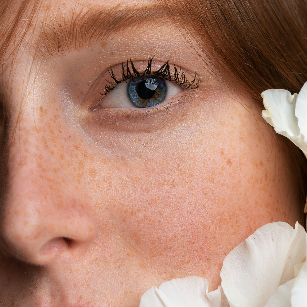 aesthetics-chemical-peel